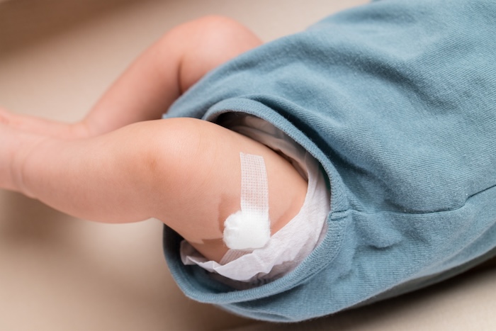 Infant with a bandaid after receiving the Vitamin K immunization shot. 
